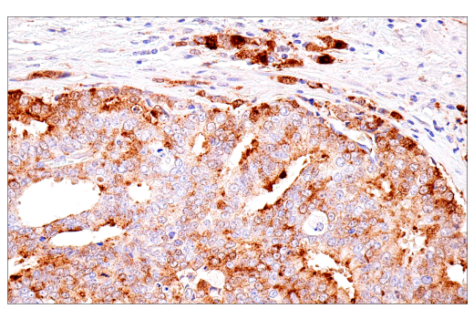 Immunohistochemistry Image 2: α-Synuclein (E4U2F) XP<sup>®</sup> Rabbit mAb (BSA and Azide Free)