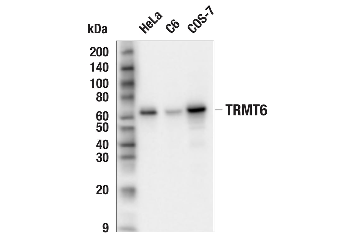 Western Blotting Image 1: TRMT6 (E7L3M) Rabbit mAb