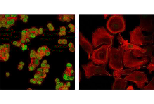 Immunofluorescence Image 1: GATA-6 (D61E4) XP<sup>®</sup> Rabbit mAb (BSA and Azide Free)