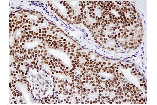 undefined Image 2: BAF Complex IHC Antibody Sampler Kit