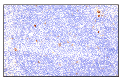 Immunohistochemistry Image 4: Phospho-SLP-76 (Ser376) (E3G9U) XP<sup>®</sup> Rabbit mAb