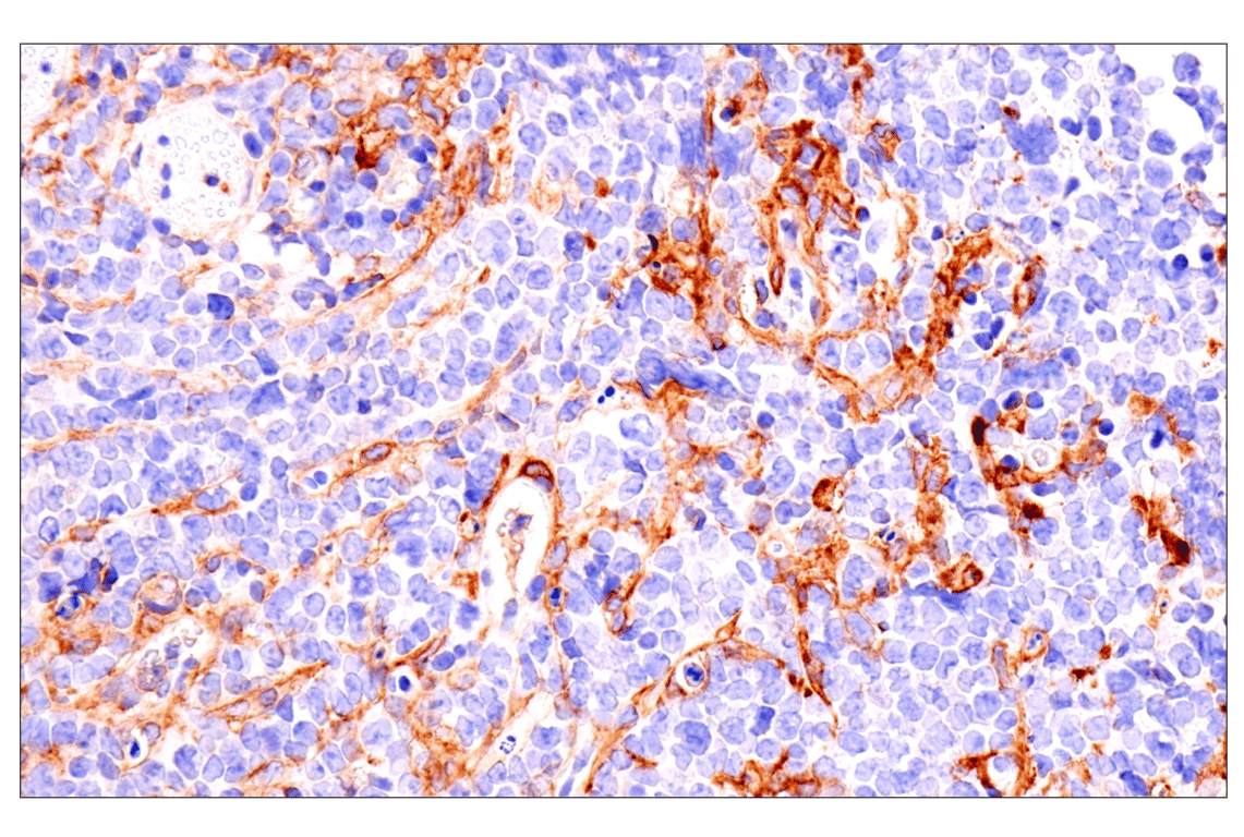 Immunohistochemistry Image 1: Axl (E3Z2H) Rabbit mAb