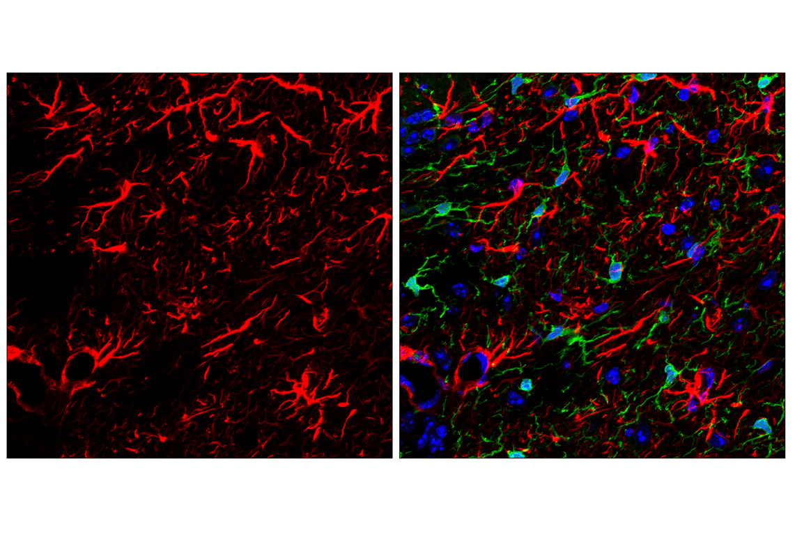 Immunofluorescence Image 1: GFAP (E4L7M) XP<sup>®</sup> Rabbit mAb (Alexa Fluor<sup>®</sup> 647 Conjugate)