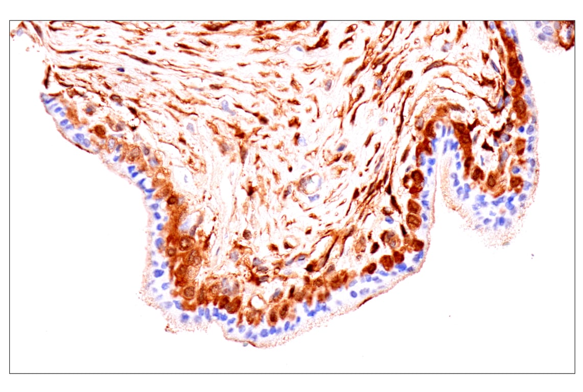 Immunohistochemistry Image 8: Phospho-YAP (Ser61) (E4Q8S) Rabbit mAb