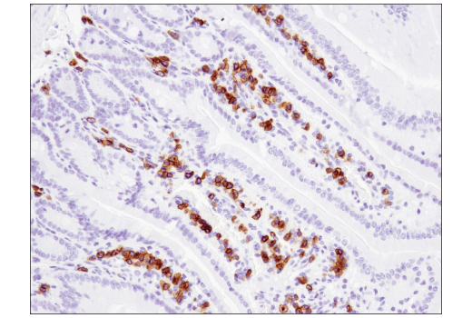 Immunohistochemistry Image 4: CD79B (D7V2F) Rabbit mAb