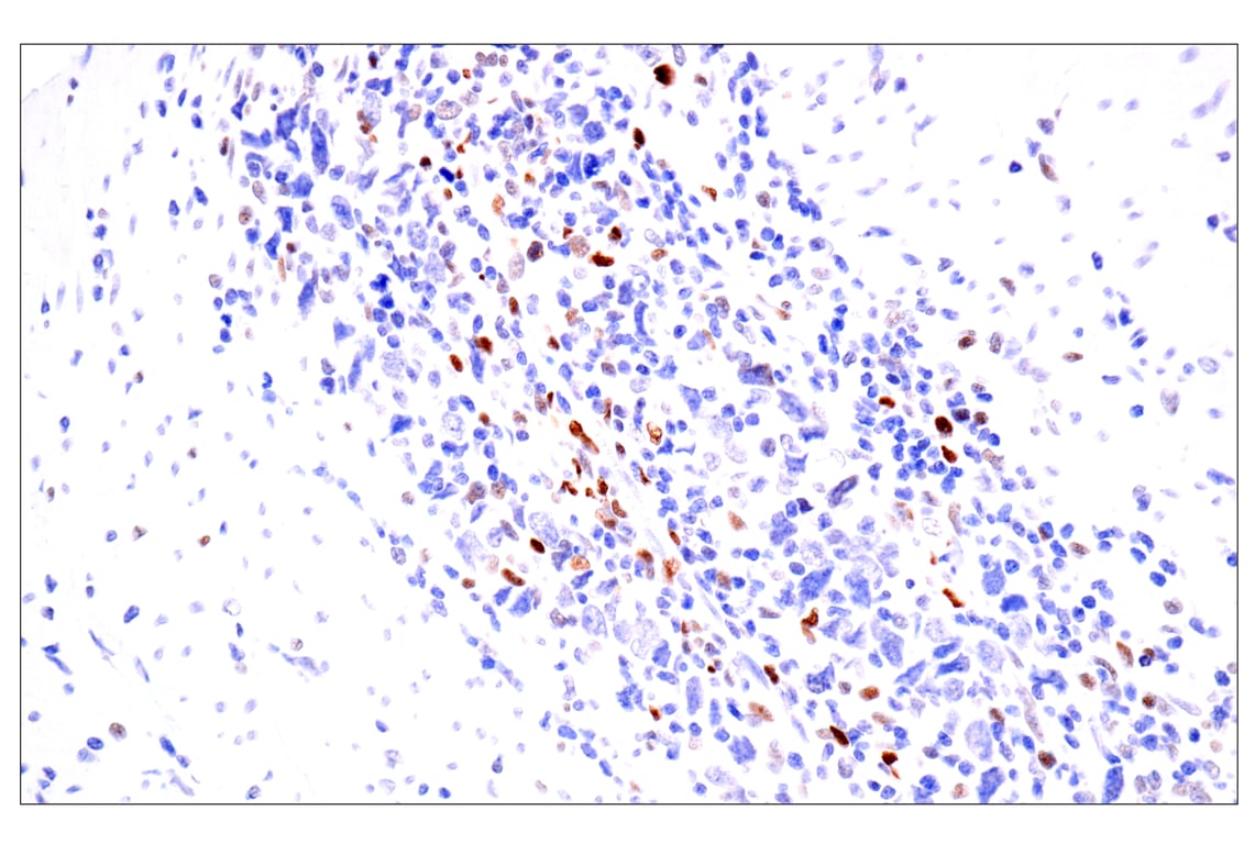 Immunohistochemistry Image 3: BATF3 (E3F3L) Rabbit mAb