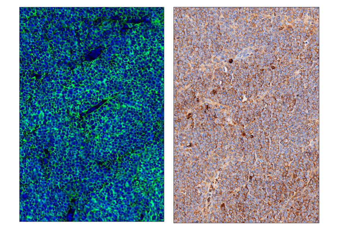 Immunohistochemistry Image 6: CD20 (E3N7O) & CO-0134-750 SignalStar<sup>™</sup> Oligo-Antibody Pair
