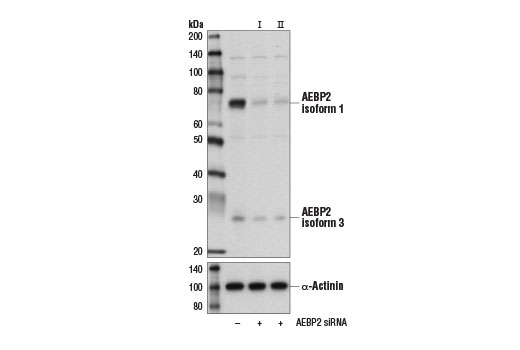 Western Blotting Image 2: AEBP2 (D7C6X) Rabbit mAb