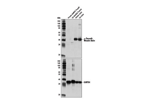 Western Blotting Image 1: α-Smooth Muscle Actin Antibody