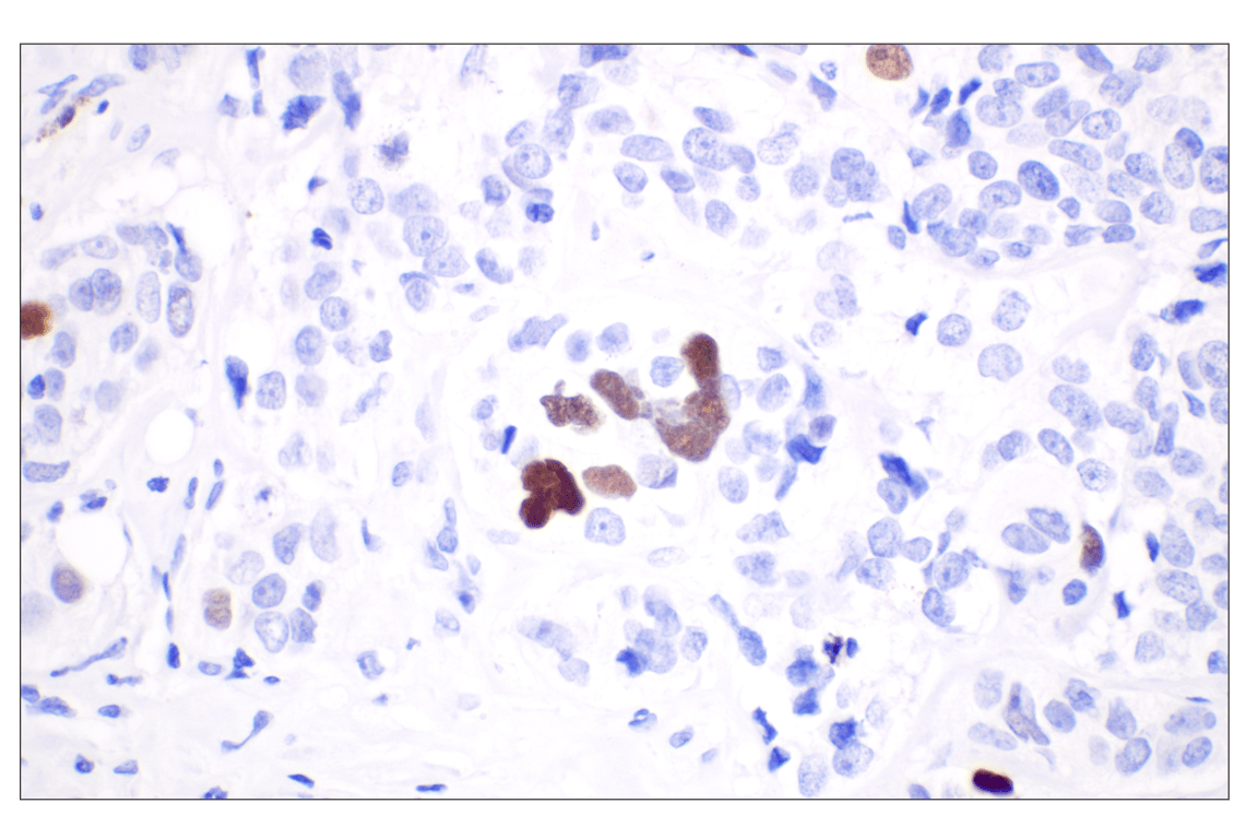undefined Image 8: Non-Homologous End Joining (NHEJ) DNA Repair Antibody Sampler Kit