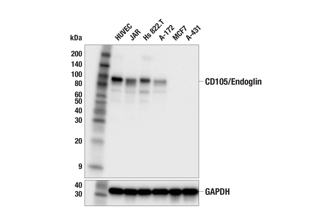 Western Blotting Image 2: CD105/Endoglin (F9C5Q) Rabbit mAb