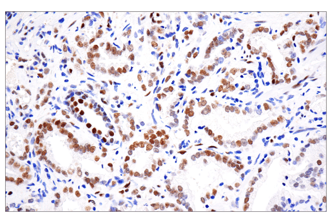 undefined Image 16: Stat3/Stat5 Signaling Antibody Sampler Kit