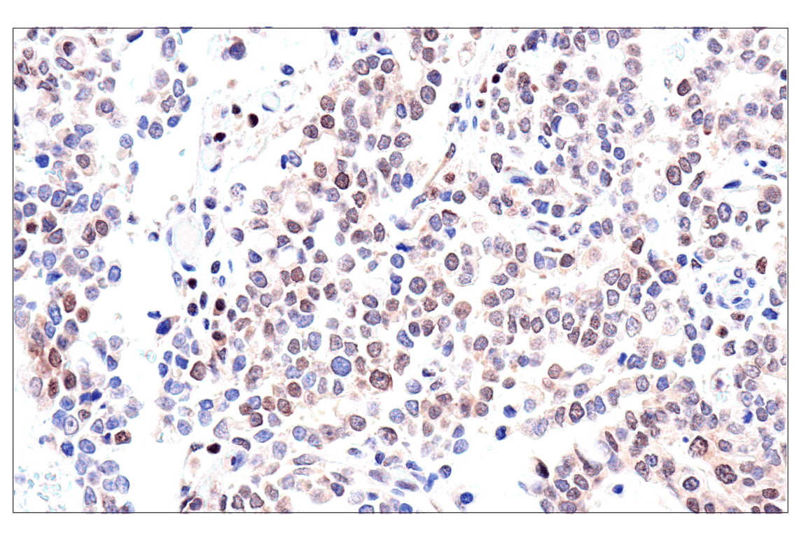 Immunohistochemistry Image 6: ADAR1 p150 Isoform   (E6U1U) Rabbit mAb   (BSA and Azide Free)