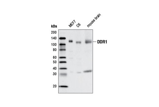 Western Blotting Image 1: DDR1 (D1G6) XP<sup>®</sup> Rabbit mAb