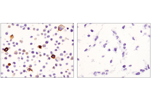 undefined Image 44: Mouse Reactive M1 vs M2 Macrophage IHC Antibody Sampler Kit