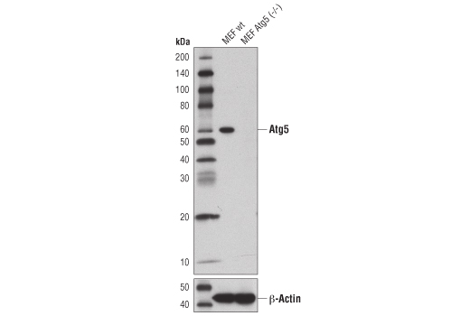 Western Blotting Image 2: Atg5 (D5F5U) Rabbit mAb