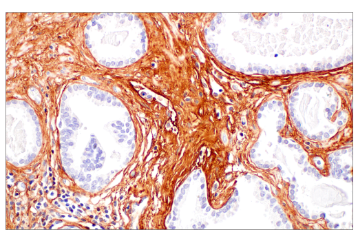 Immunohistochemistry Image 8: COL3A1 (E8D7R) XP<sup>®</sup> Rabbit mAb (BSA and Azide Free)