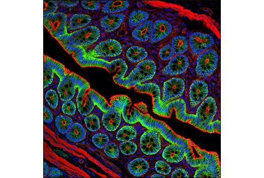 Immunofluorescence Image 1: Phospho-β-Catenin (Ser675) (D2F1) XP<sup>®</sup> Rabbit mAb