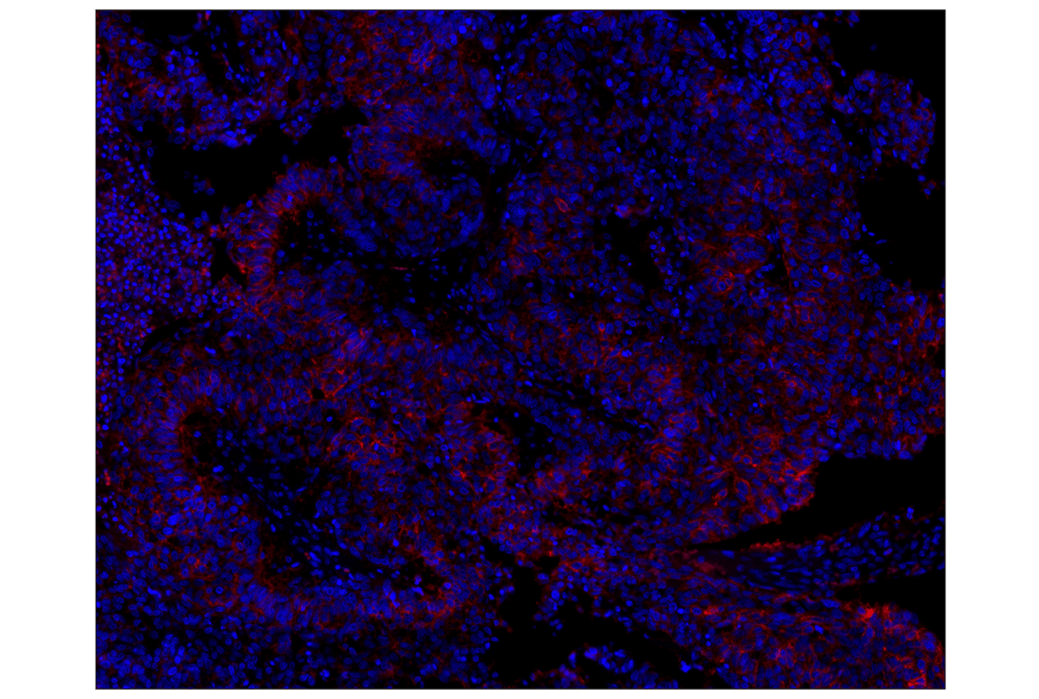 Immunohistochemistry Image 1: NCAM1 (CD56) (E7X9M) XP<sup>®</sup> Rabbit mAb (Alexa Fluor<sup>®</sup> 647 Conjugate)