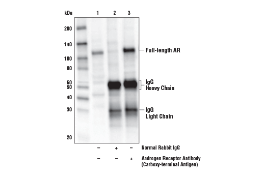 Immunoprecipitation Image 1: Androgen Receptor Antibody (Carboxy-terminal Antigen)