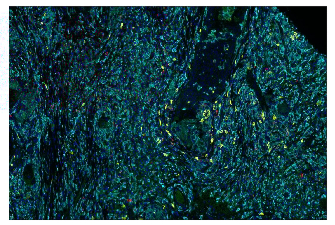 Immunohistochemistry Image 7: Granzyme B (D6E9W) & CO-0009-488 SignalStar<sup>™</sup> Oligo-Antibody Pair