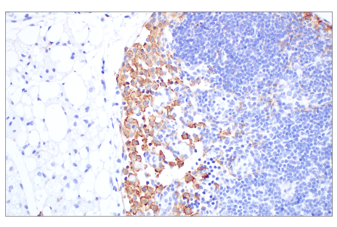 Immunohistochemistry Image 3: Siglec-1/CD169 (E1D7G) Rabbit mAb