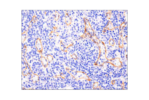 Immunohistochemistry Image 1: N-Cadherin (D4R1H) XP<sup>®</sup> Rabbit mAb