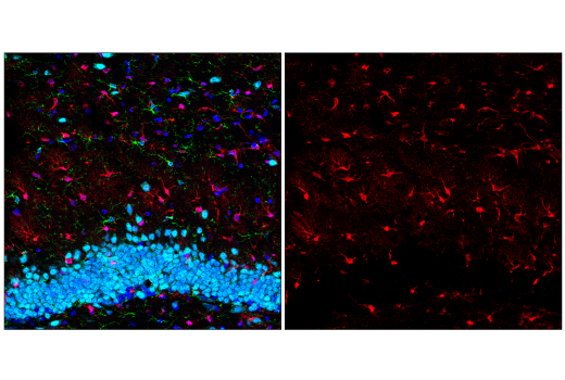 Immunofluorescence Image 3: S100B (E7C3A) Rabbit mAb