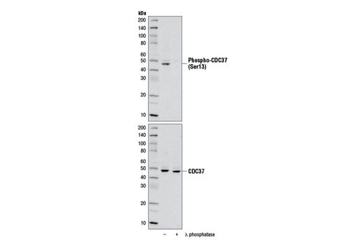 Western Blotting Image 2: Phospho-CDC37 (Ser13) (D8P8F) Rabbit mAb