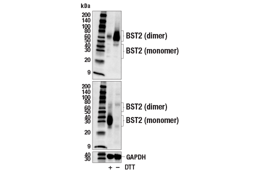 Western Blotting Image 2: BST2 (E4N3W) XP<sup>®</sup> Rabbit mAb