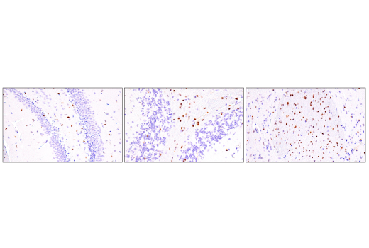 Immunohistochemistry Image 5: Olig2 (E6G6Q) XP<sup>®</sup> Rabbit mAb (BSA and Azide Free)