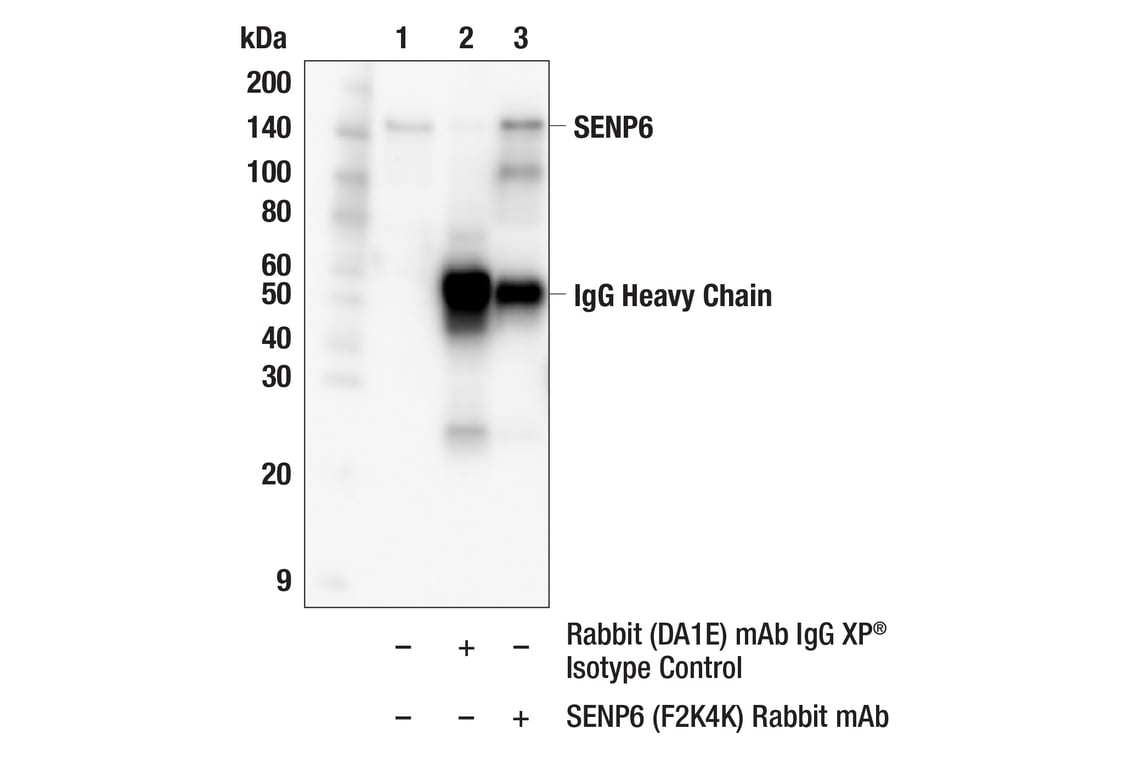 Immunoprecipitation Image 1: SENP6 (F2K4K) Rabbit mAb