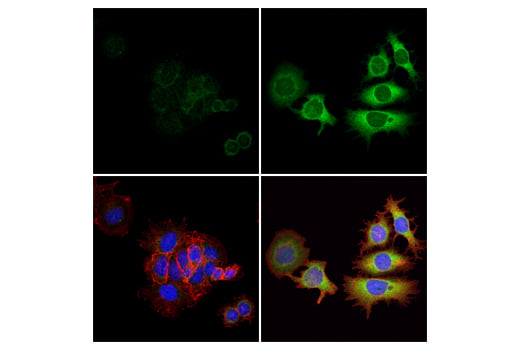 undefined Image 4: PhosphoPlus <sup>®</sup> GCN2 (Thr899) Antibody Duet