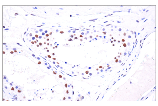 undefined Image 68: BAF Complex IHC Antibody Sampler Kit