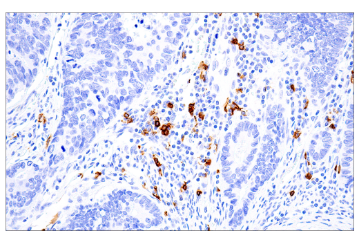 Immunohistochemistry Image 4: CD20 (L26) Mouse mAb