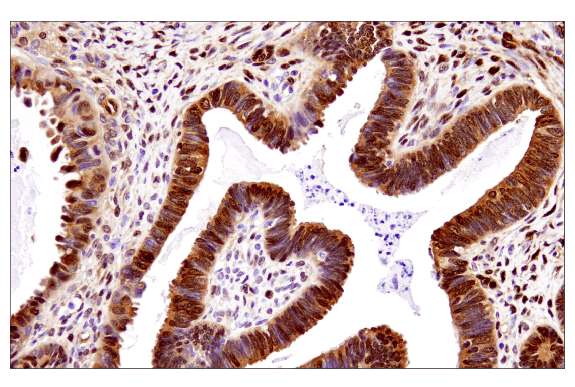 Immunohistochemistry Image 3: YAP (D8H1X) XP<sup>®</sup> Rabbit mAb