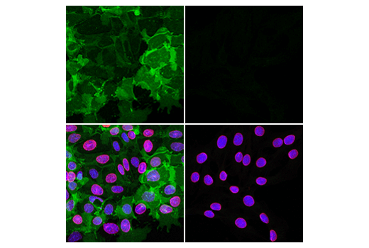 Immunofluorescence Image 1: EpCAM (E8Q1Z) Rabbit mAb