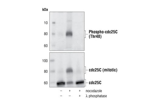 Western Blotting Image 2: cdc25C (5H9) Rabbit mAb