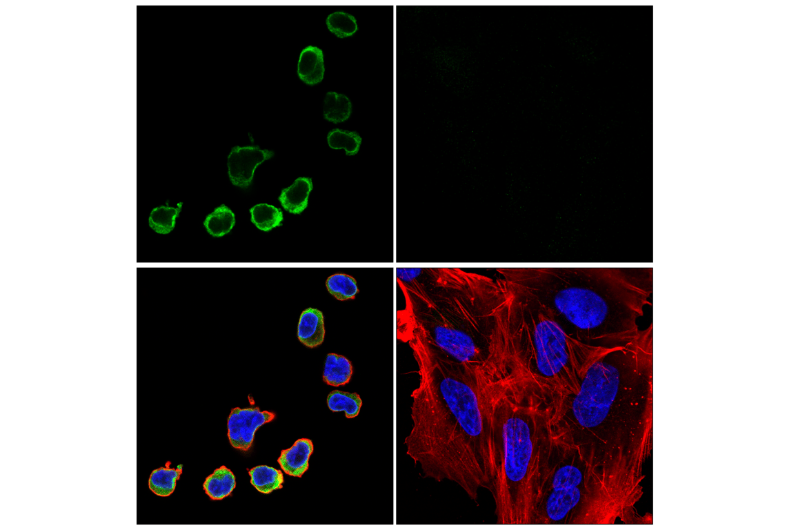 Immunofluorescence Image 2: STING (E9X7F) Rabbit mAb