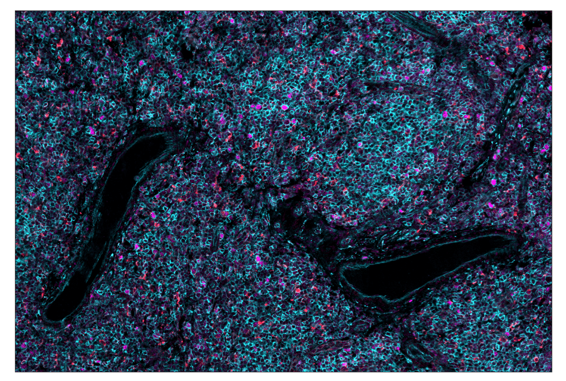 Immunohistochemistry Image 1: OX40L (D6K7R) & CO-0087-750 SignalStar<sup>™</sup> Oligo-Antibody Pair