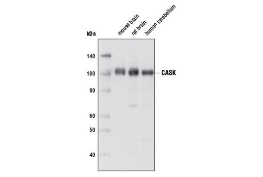 Western Blotting Image 1: CASK (D24B12) Rabbit mAb