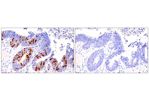 Immunohistochemistry Image 8: Cyclin A2 (E6D1J) XP<sup>®</sup> Rabbit mAb