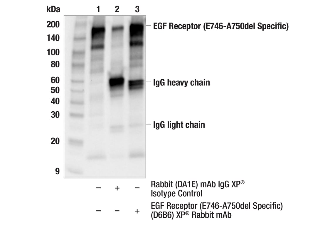 undefined Image 19: Lung Cancer RTK Antibody Sampler Kit