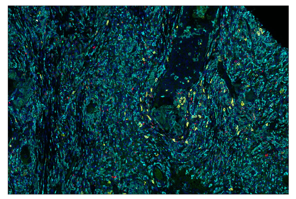 Immunohistochemistry Image 1: HLA-DRA (E9R2Q) & CO-0023-750 SignalStar<sup>™</sup> Oligo-Antibody Pair