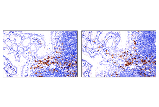 Immunohistochemistry Image 3: IL-2Rα/CD25 (E4B2Z) XP<sup>®</sup> Rabbit mAb (BSA and Azide Free)