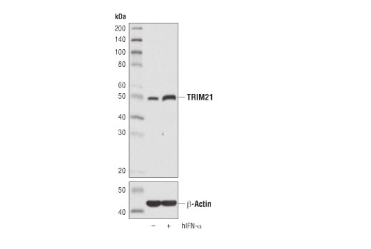 Western Blotting Image 2: TRIM21 (D1O1D) Rabbit mAb