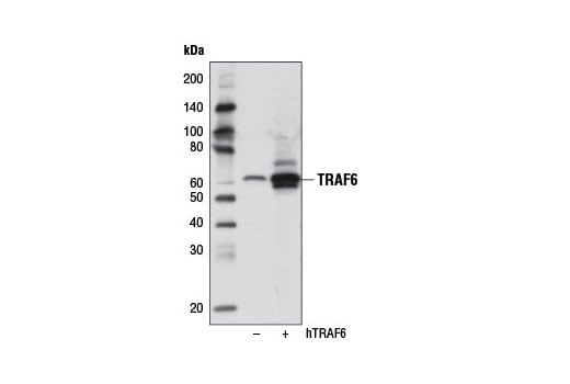 Western Blotting Image 1: TRAF6 (D21G3) Rabbit mAb