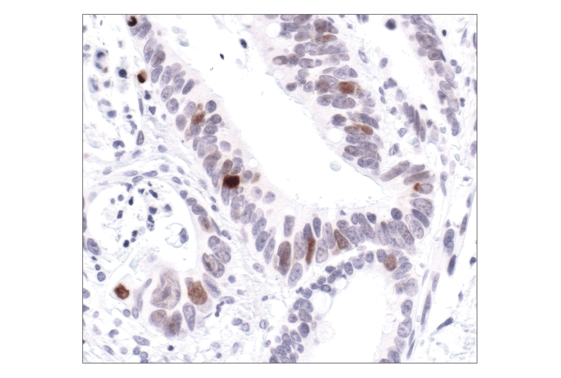 Immunohistochemistry Image 2: Phospho-Histone H2A.X (Ser139) (20E3) Rabbit mAb