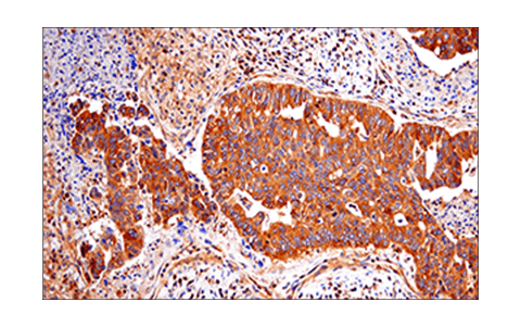 Immunohistochemistry Image 1: RIP (E8S7U) XP<sup>®</sup> Rabbit mAb