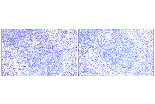 Immunohistochemistry Image 13: T-bet/TBX21 (E4I2K) Rabbit mAb